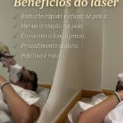 Saiba os benefícios do laser na depilação!