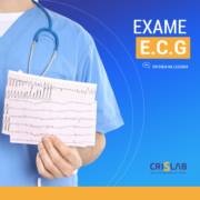 Exame E.C.G