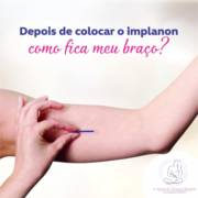 Como fica o braço após a colocação do implanon