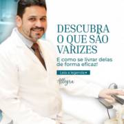 Você sabe o que são Varizes? Descubra o que são e como se librar delas de forma eficaz!