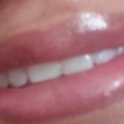 Porque fazer hydra gloss labial?