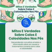 Mitos E Verdades Sobre Calos E Calosidades Nos Pés