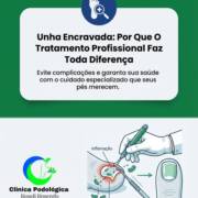 Unha Encravada: Por Que O Tratamento Profissional Faz Toda Diferença