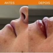 Realçando a beleza dos seus lábios. Contorno, volume e hidratação!