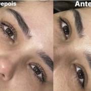 Lash Lifting