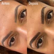 Brow Lamination