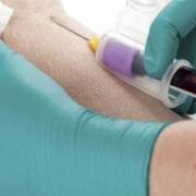 Saiba a importância de realizar o hemograma completo
