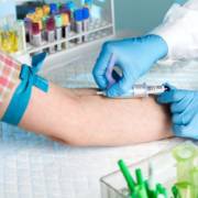 Por que fazer jejum para exame de sangue é tão importante?
