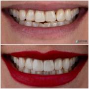 Cuidar do Sorriso Hoje Pode Fazer Diferença por Muitos Anos