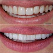 Um sorriso renovado com naturalidade e elegância.