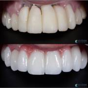 Cada detalhe faz diferença na reconstrução de um sorriso.