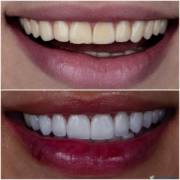 Cada detalhe faz diferença no seu sorriso