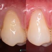 Pequenos detalhes podem transformar o sorriso