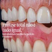 Prótese total em Francisco Beltrão