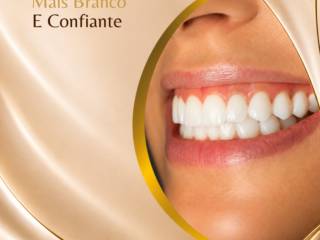 Clareamento Dental: Um Sorriso Mais Branco e Confiante