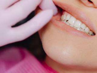 Sorriso Saudável em Sarandi PR: Como a Odontologia Cardoso Faz a Diferença