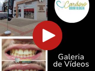 Galeria de Vídeos 