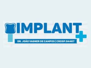 Referência em Saúde Bucal: Dr. João Vagner de Campos oferece atendimento odontológico de excelência em Lençóis Paulista