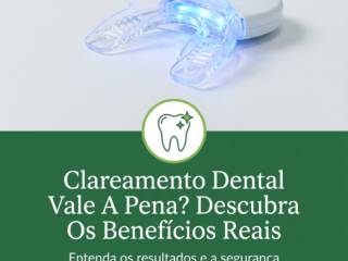 Clareamento Dental Vale A Pena? Descubra Os Benefícios Reais