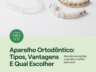 Aparelho Ortodôntico: Tipos, Vantagens E Qual Escolher