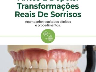 Antes E Depois: Transformações Reais De Sorrisos