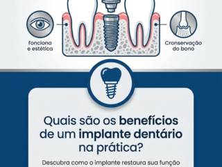 Quais são os benefícios de um implante dentário na prática?