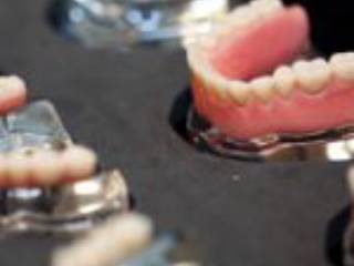 Perguntas frequentes sobre tratamentos dentários