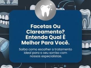 Facetas Ou Clareamento? Entenda Qual É Melhor Para Você