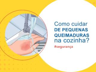 Como cuidar de pequenas queimaduras na cozinha?