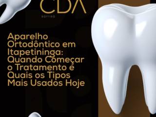 Aparelho Ortodôntico em Itapetininga: Quando Começar o Tratamento e Quais os Tipos Mais Usados Hoje