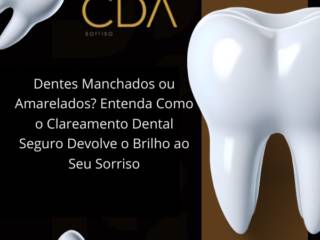 Dentes Manchados ou Amarelados? Entenda Como o Clareamento Dental Seguro Devolve o Brilho ao Seu Sorriso