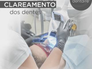 Quanto tempo dura clareamento dental?
