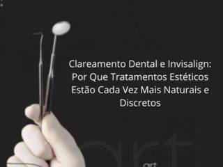 Clareamento Dental e Invisalign: Por Que Tratamentos Estéticos Estão Cada Vez Mais Naturais e Discretos