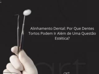 Alinhamento Dental: Por Que Dentes Tortos Podem Ir Além de Uma Questão Estética?