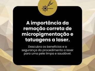A importância da remoção correta de micropigmentação e tatuagens a laser