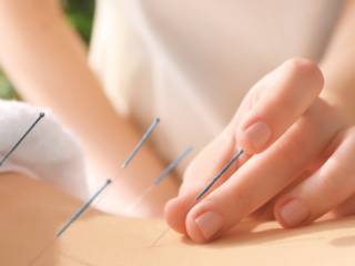 8 benefícios da acupuntura para a saúde