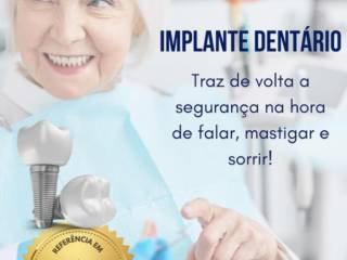 Implantes Dentários