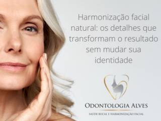 Harmonização facial natural: os detalhes que transformam o resultado sem mudar sua identidade