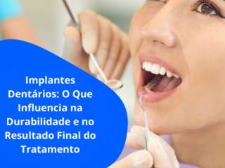 Implantes Dentários em Itapetininga: O Que Influencia na Durabilidade e no Resultado Final do Tratamento