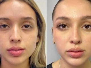 Mais Jovem, Mais Bonita, Mais Você – Com a Clínica Joice Melo!