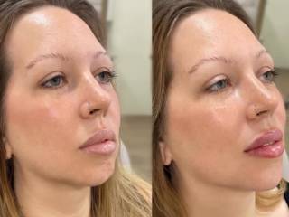 Realce sua beleza na Clínica Joice Melo em Mineiros