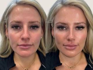 Beleza com naturalidade e equilíbrio, só aqui na Joice Melo em Mineiros 