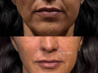 Estética e qualidade andam juntas: vem para a Clínica Joice Melo