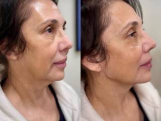 Realçando sua beleza com naturalidade
