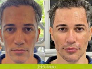 Homens também podem cuidar da estética na Clínica Joice Melo