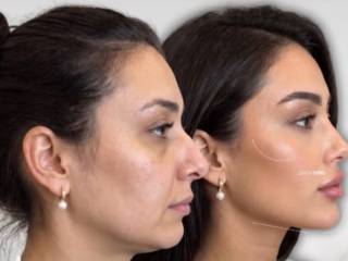 Beleza facial com naturalidade e confiança em Mineiros
