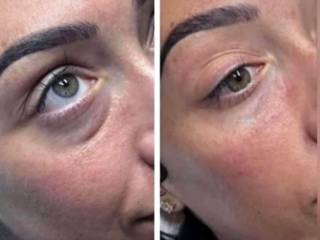  Procedimentos faciais pensados para realçar o que você já tem de melhor