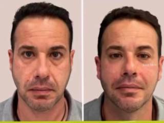 Cuidar do rosto também faz parte da rotina masculina