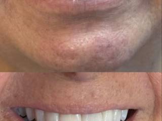 Sorriso alinhado, natural e cheio de confiança