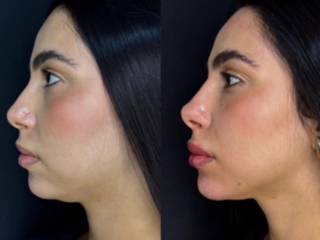 Quer realçar ainda mais sua beleza? Conte com a Harmonize - Saúde e Estética em Mineiros!